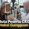 2,95 Juta Peserta CKG Terdeteksi Gangguan Mata